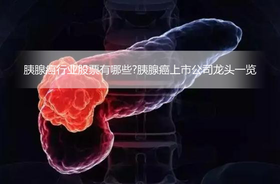 胰腺癌行业股票有哪些?胰腺癌上市公司龙头一览