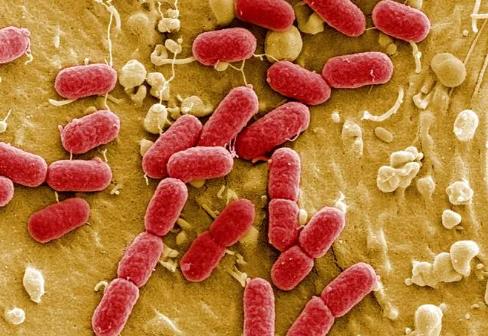超级细菌概念股有哪些?